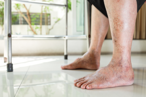 Arterial Disease Management