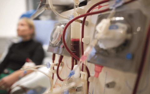 Hemodialysis Access Surgery